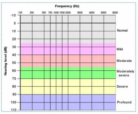 degrees_hearing_loss